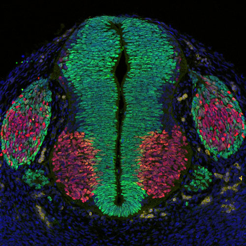 Gene expression in the human embryonic spinal cord